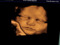 Ari in her mom's belly